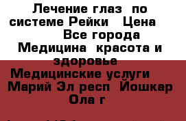 Лечение глаз  по системе Рейки › Цена ­ 300 - Все города Медицина, красота и здоровье » Медицинские услуги   . Марий Эл респ.,Йошкар-Ола г.